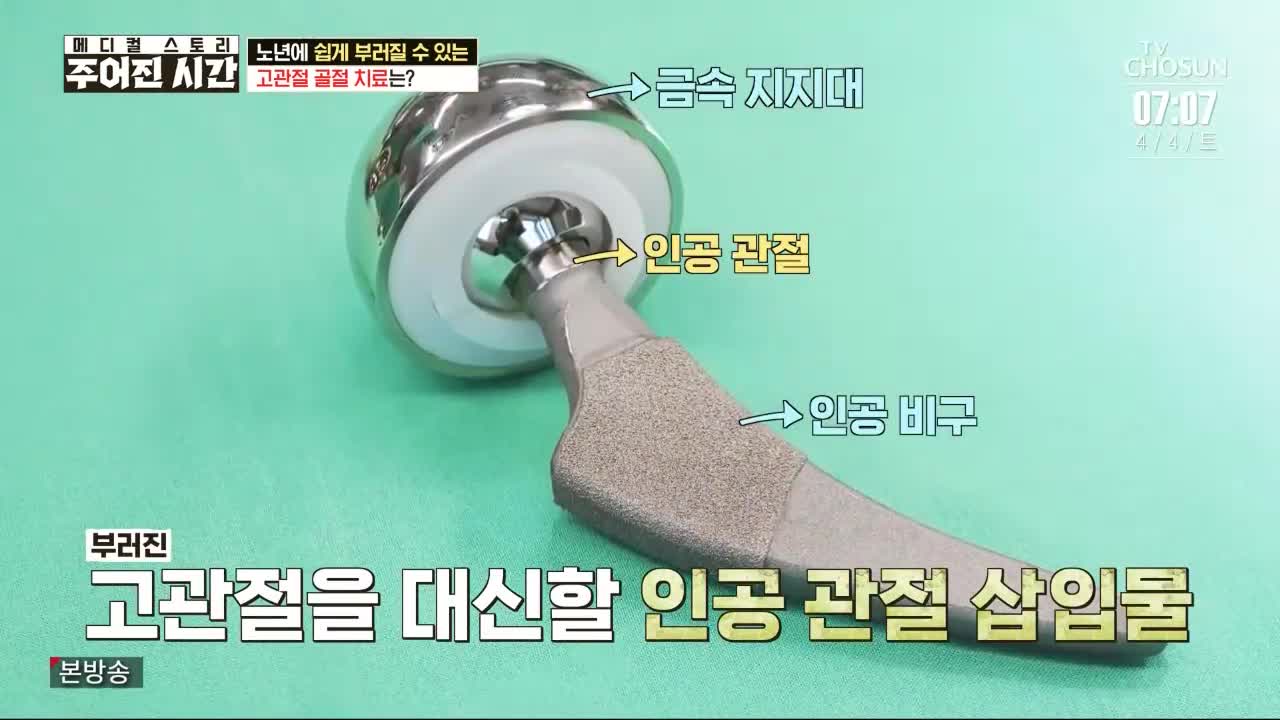 더보기